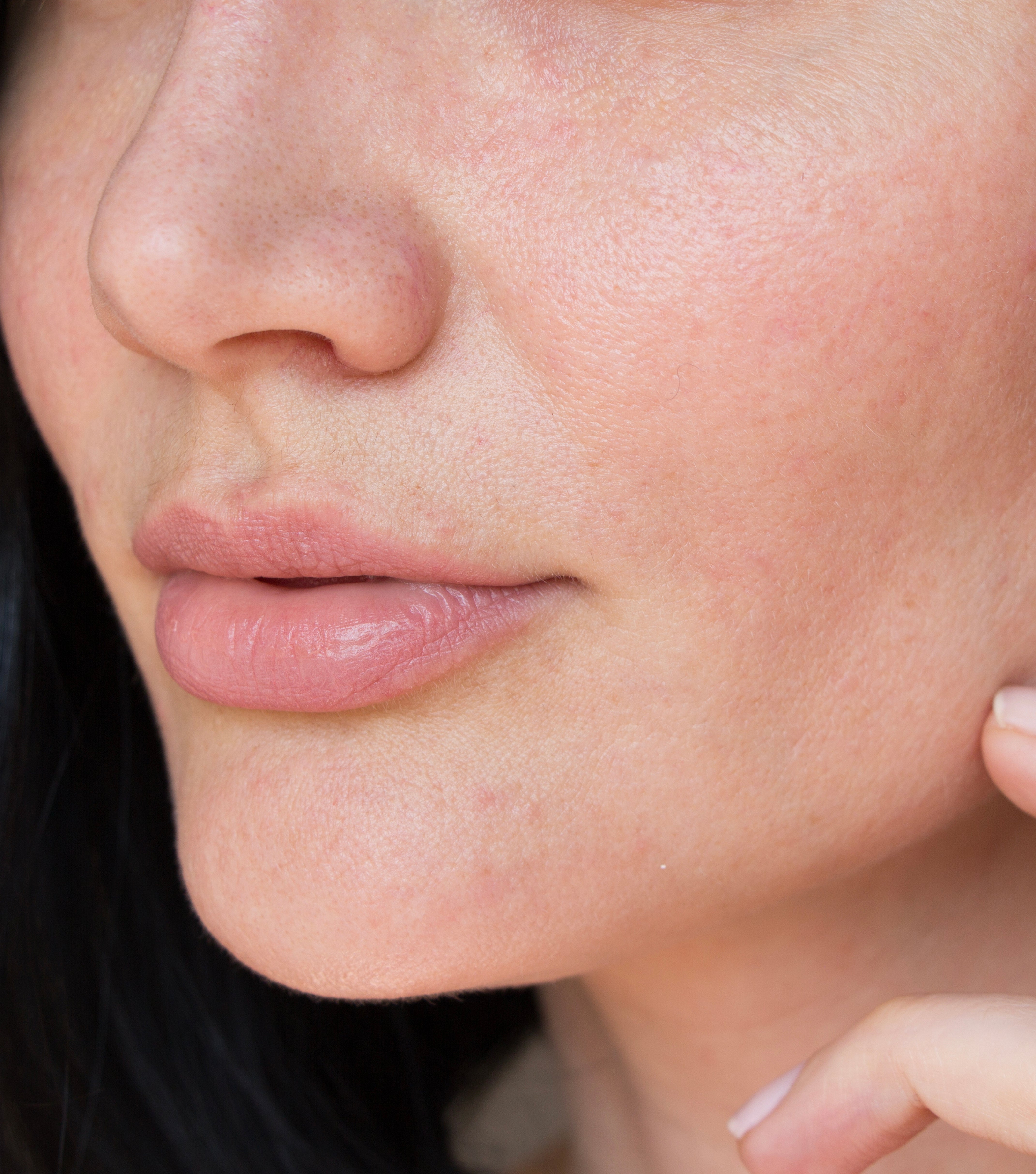 Dehydrated Skin vs. Dry Skin: Understanding What Your Skin Needs
