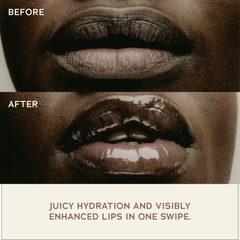 Lip Treatment
